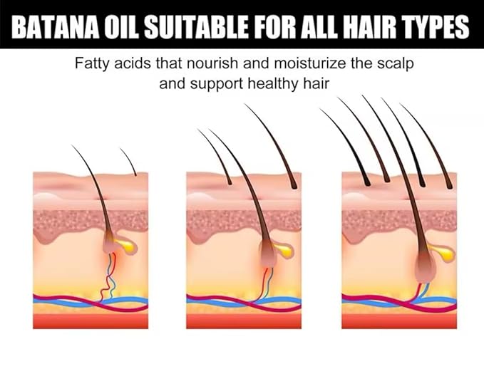 Eelhoe Batana Oil for Hair Growth, 2.02 fl oz, Hair Thickening Treatment with Vitamin E