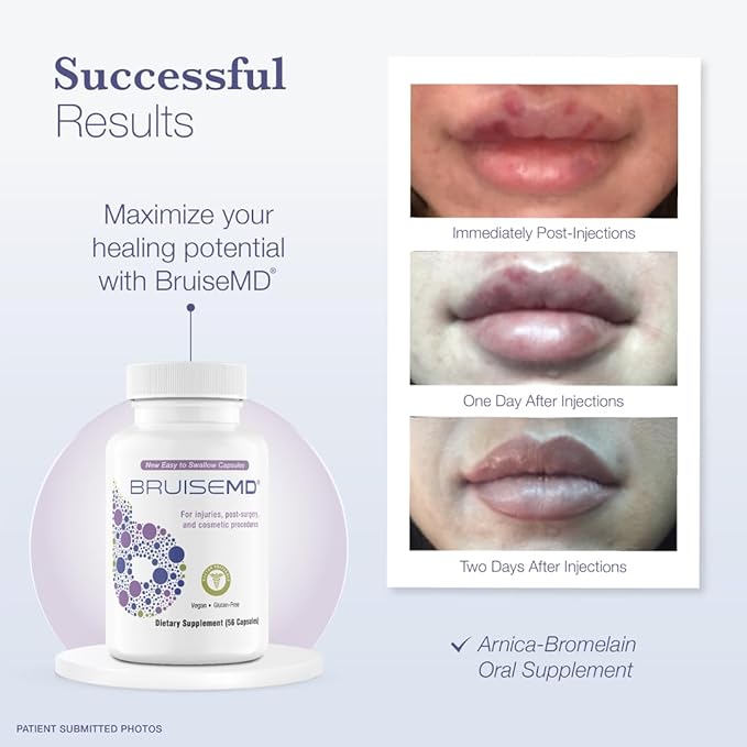 Arnica 1,000mg and Bromelain 500mg 2,400GDU/g Supplement for Bruising and Swelling, Easy to Swallow Capsules (14-Day Supply) - Advanced Bruise Treatment Formula