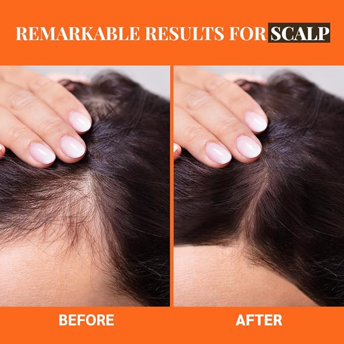 Well's Oil Batana Oil | 2 fl. oz. | 100% Natural Organic Raw Batana from Honduras | Dr. Sebi Approved | Strengthens, Hydrates & Nourishes | For All Hair Typess (2 fl. oz. / 59 ml)