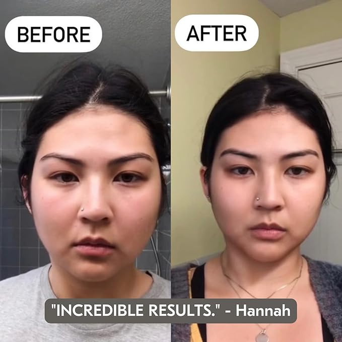 Mount Lai Amethyst Trio Calming Facial Set, Facial Roller and Amethyst Gua Sha Facial Tools Set, Guasha Tool for Face to Relieve Muscle Tension and Reduce Puffiness, Anti Aging Skin Care Sets