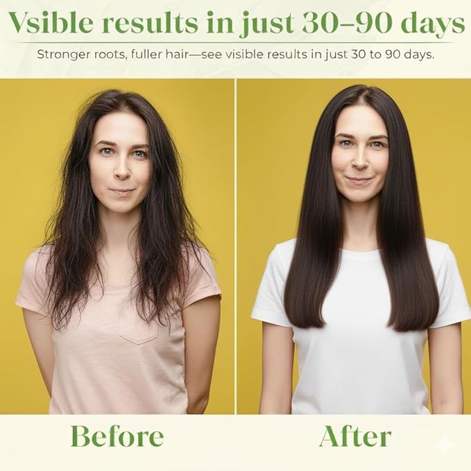 Scalp Hair Growth Serum -Thicker and Fuller Looking Hair - Paraben Smell Free- Nourishing Formula with Rosemary Biotin Caffeine Red Clover Hair Regrowth Treatment for Women Men - 1 Fl.Oz