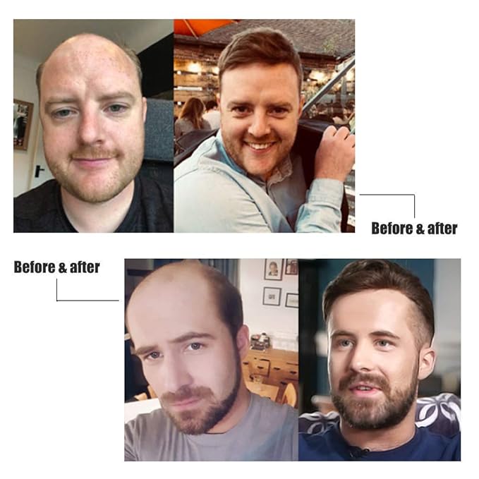 Lordhair Toupee for Men European human hair Full French Lace Hairpieces，Base Size 7x9 inch Hair Replacement System for Men Natural Hairline Human Hair Wig Medium Brown #5