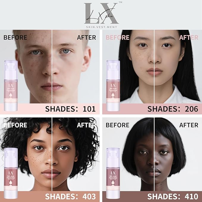 Acne-serum Foundation with Salicylic Acid & Vitamin E, Sensitive Skin Foundation Vegan & Non-Comedogenic for Acne Prone Skin Care (Deep-403)