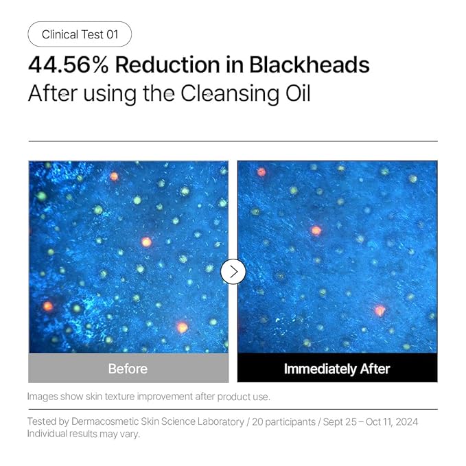 Parnell AHA Omija Ceramic Cleansing Oil 6.76 fl oz | Pore Purifying Sebum Control Deep Cleanser | AHA LHA PHA Omija | Non-Drying Korean Skincare (200ml)