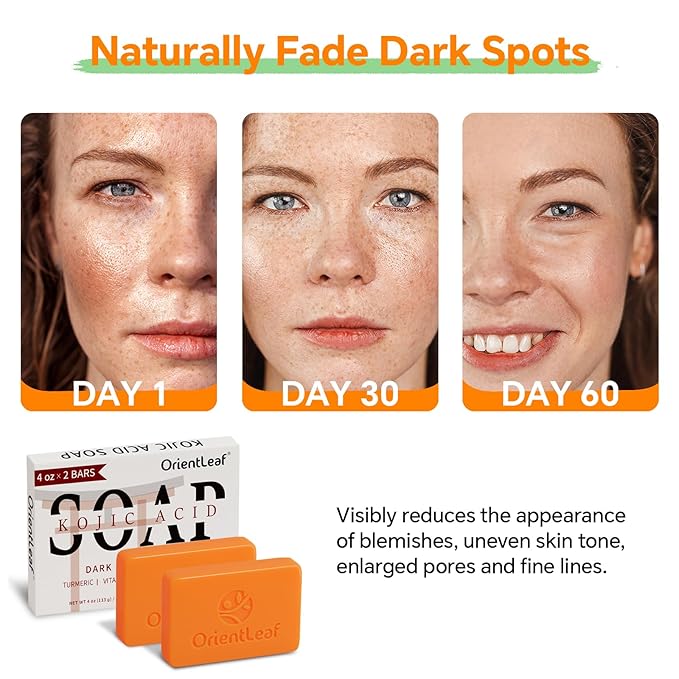 Kojic Acid and Turmeric Soap for Dark Spots Remover, Brightening, Hyperpigmentation for Face, 4oz x 2 BARS