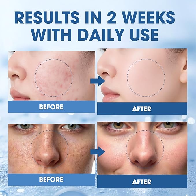 Salmon DNA PDRN Peptide Serum – Hydrating, Firming & Brightening, Uneven Skin Tone, 1.01 fl.oz.