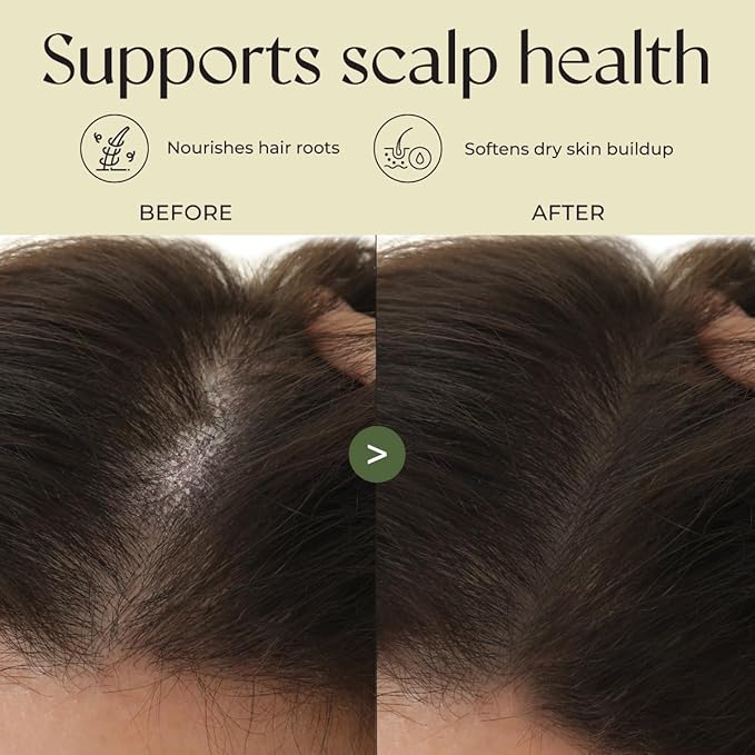 Gya Labs Rosemary & Castor Hair Oil - 4 Fl Oz - for Scalp Health, Strengthens & Protection from Damage