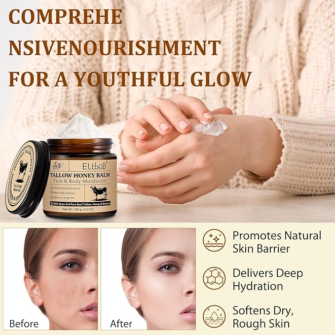 ELBBUB Whipped Tallow Cream for Face & Body - 100% Grass-Fed Beef Tallow, Natural Honey & Beeswax Moisturizer, Deep Hydration & Nourishment, Oil-Free & Unscented, Fast Absorbing