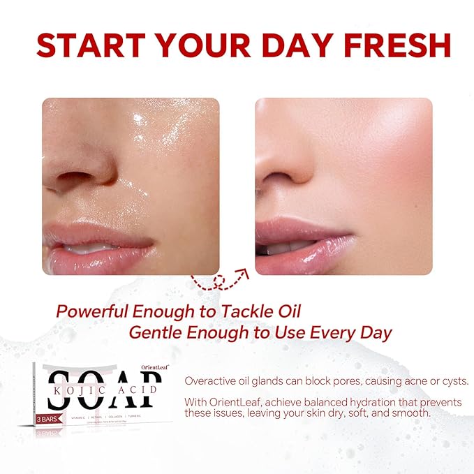 Kojic Acid Soap, Turmeric Soap Bar for Dark Spots, Fresh Citrus Scent, Gentle for Face and Body Wash with Vitamin C, Shea Butter, Retinol, Stocking Stuffers, Christmas Gifts(3 PACK)