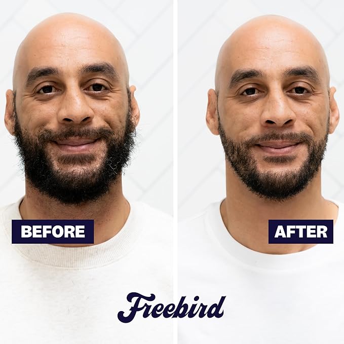 Freebird BeardSeries Trimmer for Men - Ultra Sharp Beard Trimmer with Precision Dial, Stainless Steel Blades, 40 Length Settings, Cordless & Rechargeable, for Beard, Hair, Body, & Intimate Grooming