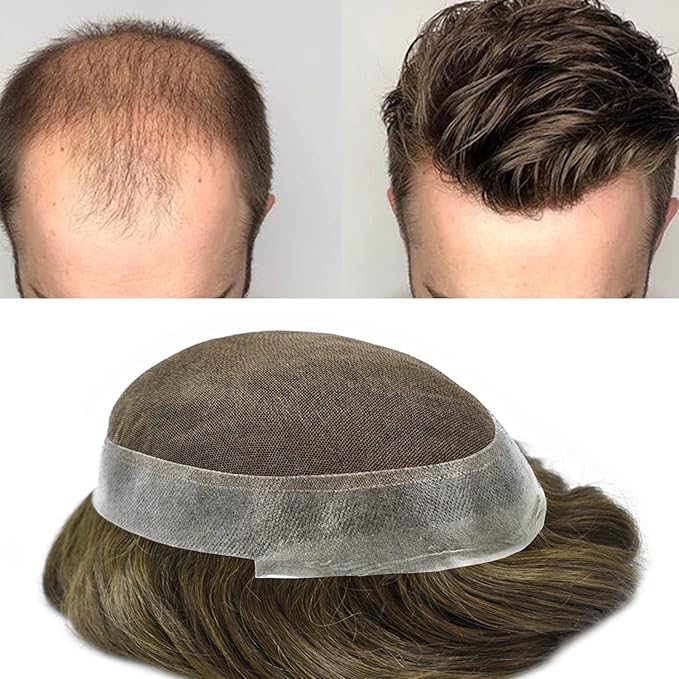 FACE MIRACLE Mens Toupee Lace Front Hairpieces Soft Human Hair Replacement System Natural Hairline Toupee for Men French Lace Poly V-Looped Mens hair Units 8"X10" 5#MEDIUM LIGHT BROWN