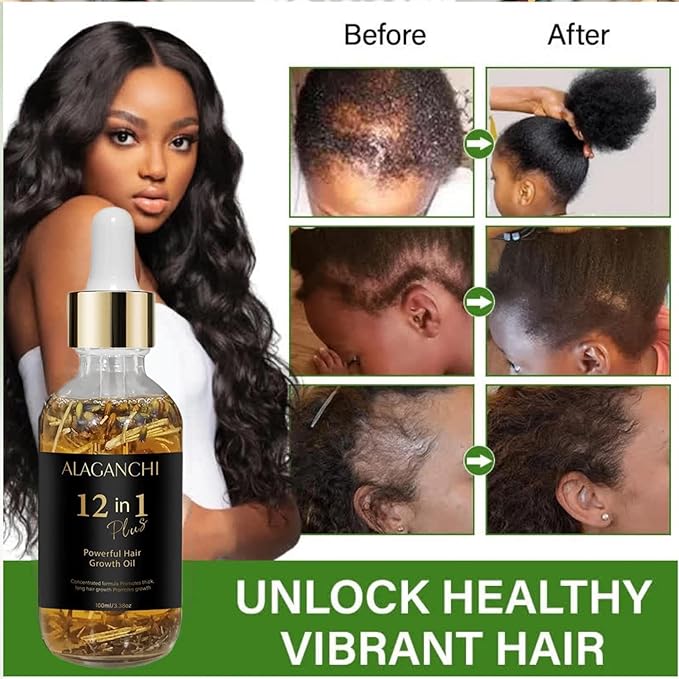 12-in-1 Hair Growth Oil – Rosemary, Amla & Castor Oil | Strengthens, Nourishes, Reduces Hair Fall | Natural Herbal Blend | Non-Greasy | Paraben & Sulfate-Free