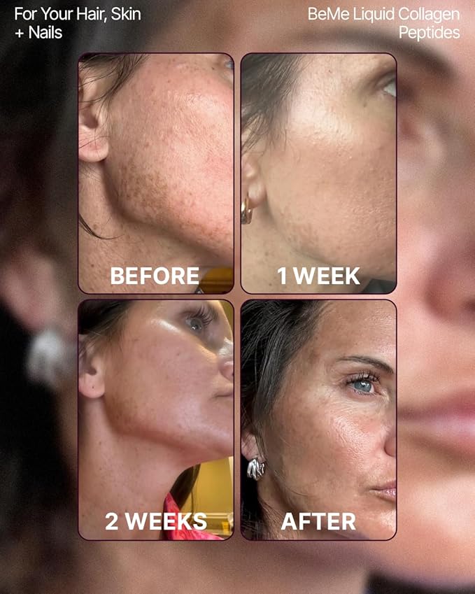 BeMe Liquid Collagen for Women - 2500mg Verisol hydrolyzed Marine Liquid Collagen - Clinically Tested Collagen Supplements - Quick Absorption, high bioavailability - Supports Skin, Hair & Nails