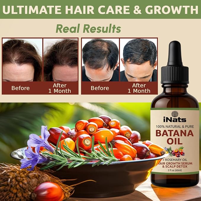 Batana Oil for Hair Growth with Rosemary: Nourish & Detox Scalp for Thicker, Stronger, Longer Hair - Dr. Sebi Recommended, 100% Organic Batana Oil from Honduras - Reduce Hair Loss (2 Fl Oz)