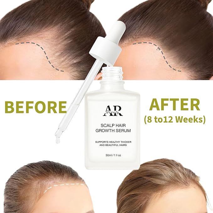 Scalp Hair Growth Serum -Thicker and Fuller Looking Hair - Paraben Smell Free- Nourishing Formula with Rosemary Biotin Caffeine Red Clover Hair Regrowth Treatment for Women Men - 1 Fl.Oz