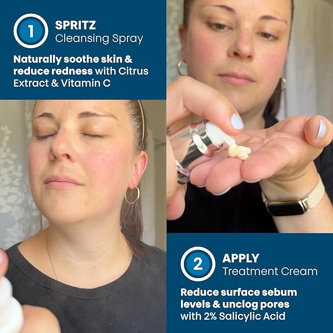 ORBE Derma Solutions Orbe It! 2-Step Acne Treatment – Clears, Treats & Prevents Acne & Helps Unclog Pores with 2% Salicylic Acid – Includes Cleansing Spray 1 oz & Treatment Cream 1 oz