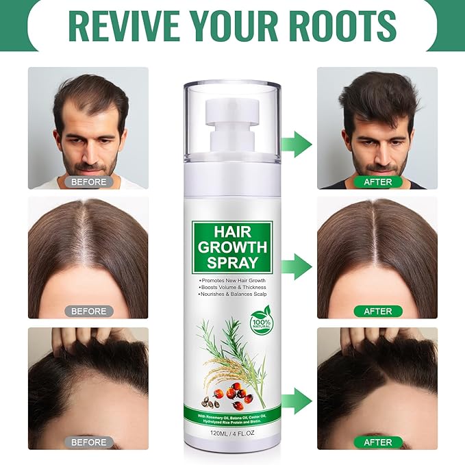 Hair Growth Serum Spray, Natural Hair Growth Spray With Biotin, Batana, Rosemary, and Castor Oil, Caffeine Ginseng Scalp Care Treatment, Thinning Hair Regrowth Thickening for Women Men 4 Fl Oz