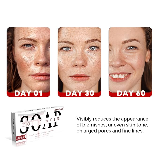 Kojic Acid Soap, Turmeric Soap Bar for Dark Spots, Fresh Citrus Scent, Gentle for Face and Body Wash with Vitamin C, Shea Butter, Retinol, Stocking Stuffers, Christmas Gifts(3 PACK)