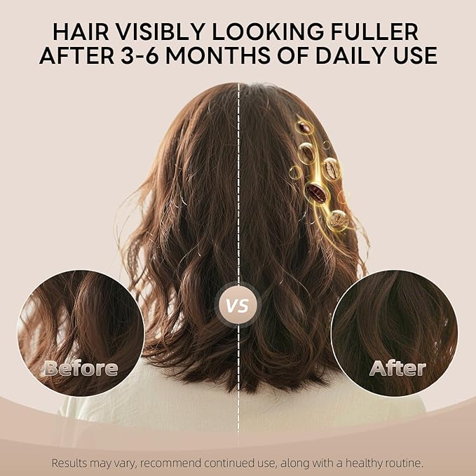 ALFHEIM Coffee+ Thickening Leave-in Spray for Fine & Thinning Hair with Caffeine, Biotin & Arabica Coffee Oil – Strengthening, Volumizing & Heat-Protecting Formula – Sulfate-Free – 5.4 oz / 160 ml