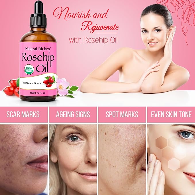 Natural Riches Organic Rosehip Seed Oil for Face 100% Pure Natural Cold Pressed Unrefined Non-GMO Carrier Oil for Skin Hair & Nails. 4 fl oz.