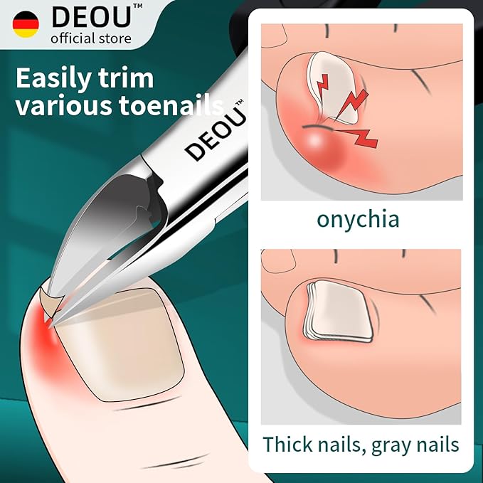 DEOU Toenail Clippers Blade for Ingrown and Thick Nails Stainless Steel Pedicure Tools at Home ingrown toenail Treatment Professional Podiatrist Nail Clippers with (Eagle Beak Pliers+Nail Remover)