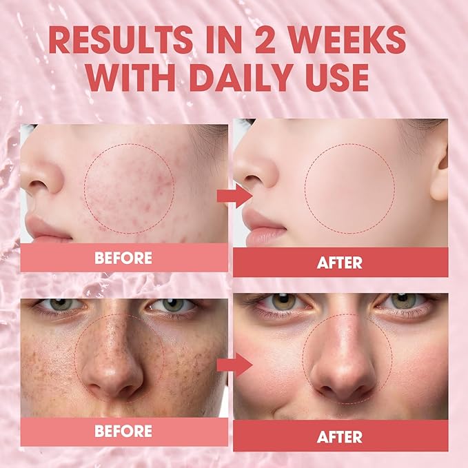 Pink Peptide 12 PDRN Serum – Salmon DNA 10,320ppm, 12 Peptides + Niacinamide for Hydrating, Firming & Glowing Skin – 30ml / 1.01 fl.oz.