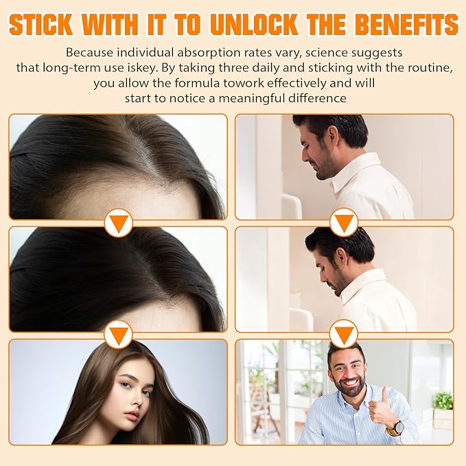 Pumpkin Seed Oil Capsules | Pumpkin Seed Oil with Saw Palmetto Softgels | Organic Pumpkin Seed Extract for Hair Growth, Bladder & Prostate Health | Cold Pressed & Pure Virgin, 1000mg, 120 Softgels