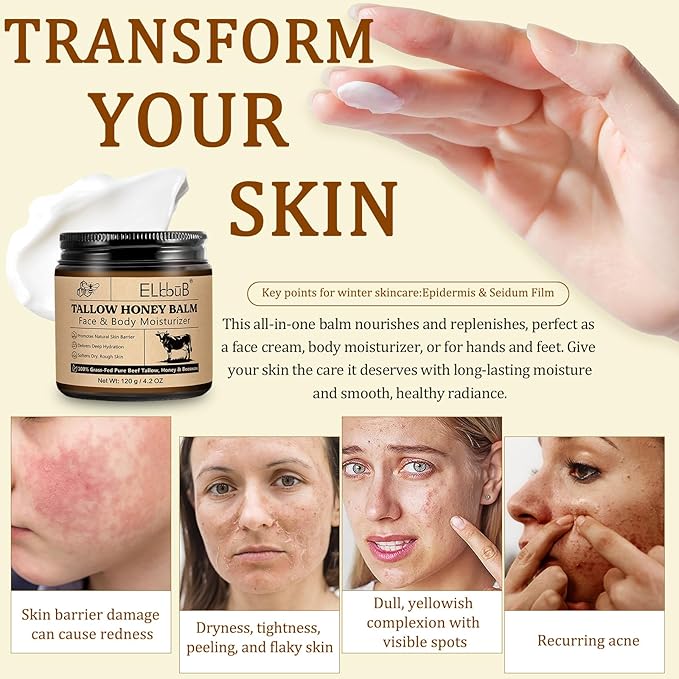 ELBBUB Whipped Tallow Cream for Face & Body - 100% Grass-Fed Beef Tallow, Natural Honey & Beeswax Moisturizer, Deep Hydration & Nourishment, Oil-Free & Unscented, Fast Absorbing