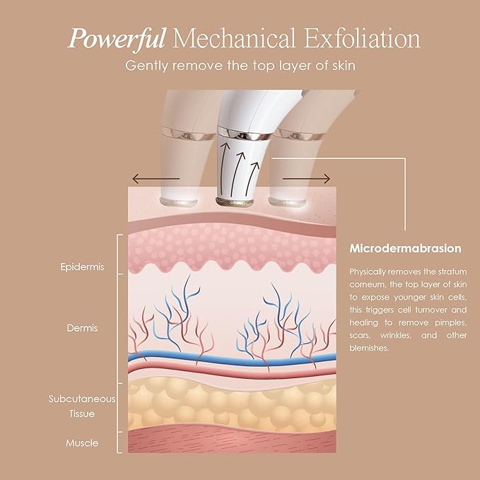 Reinvo Facial Microdermabrasion Wand by Project E Beauty | Gentle Exfoliation | Reduce Wrinkles & Fine Lines | Decrease Pores | Fresh & Radiant Skin | 4 Interchangeable Heads | Vacuum Suction Device