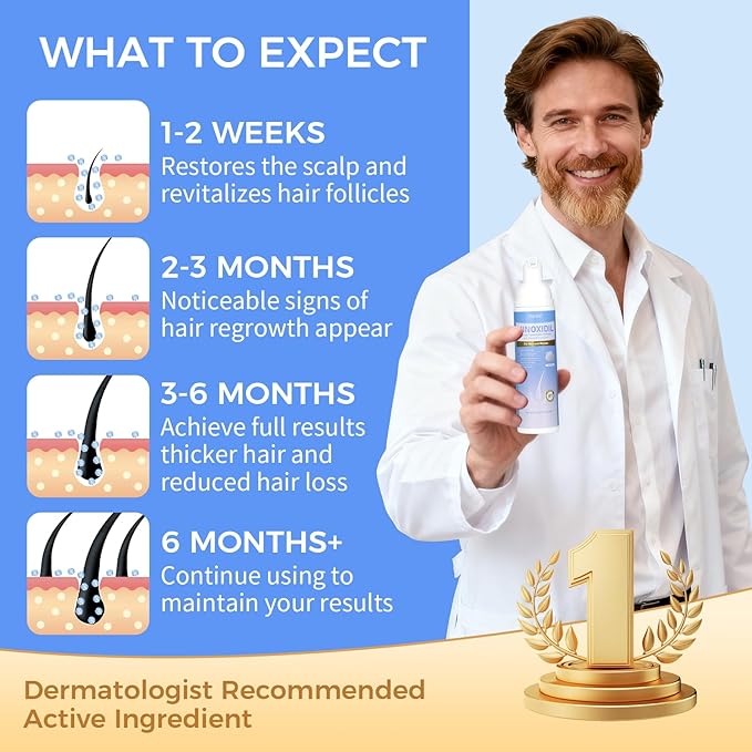 5% Minoxidil Foam for Men & Women, Hair Regrowth Treatment for Thinning Hair & Beard Growth, Extra Strength Topical Foam, Clinically Proven Hair Loss Treatment, 6 Month Supply (14OZ Total)