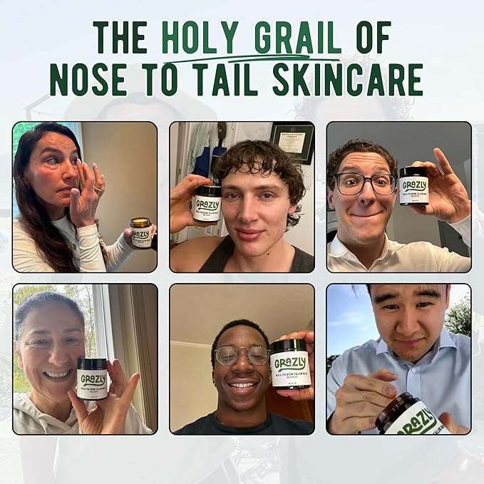 Whipped Beef Tallow for Skin w/Dead Sea Magnesium, Manuka Honey, Jojoba Oil & Vanilla - Grass Fed Beef Tallow Balm - Body & Face Moisturizer for Dry, Sensitive Skin - 2.5oz