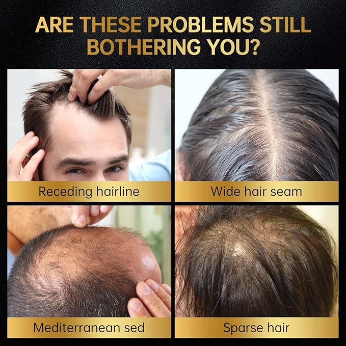 Minoxidil for Men & Women, With Biotin, Batana Oil, Rosemary Essential Oil, Effective Hair Loss Solution, Hair Loss Treatment for Hair Regrowth, Non-Greasy 5% Minoxidil - 60ml