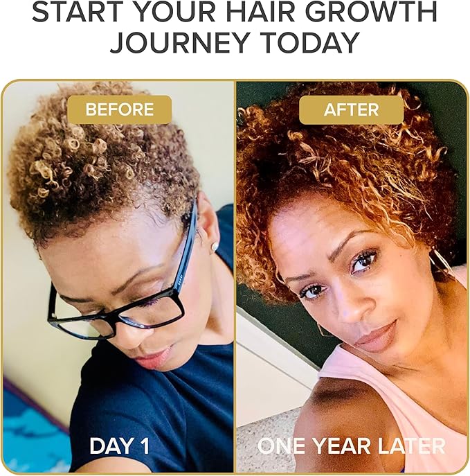 Shedavi Iconic Natural Hair Vitamins for Fast Hair Growth - Pure Hair Supplements Formulated with Vitamins to Promote Thicker, Stronger Hair - Vegan Hair Care for Hair Loss - Non-GMO (60 Capsules)