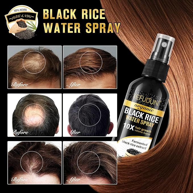Organic Black Rice Water Spray for Hair Growth, A Solution with Castor Oil & Ginger Root Extract for Thicker, Fuller Hair, Targets Hair Loss and Repairs Damage 200ml/6.4 fl.oz (2 PC)
