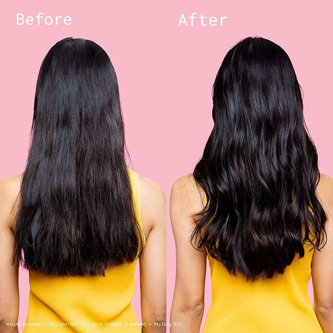 Squigs Hair Growth Oil for Dry & Damaged Hair – with Amla, Castor & Coconut Oil Blend for Frizz Control, Hydration & Scalp Treatment – Pre-Wash & Styling Treatment – 130ml