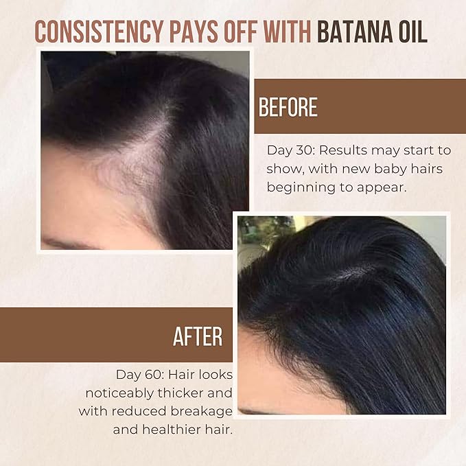 Premium Batana oil for Hair Growth |100% Raw Elaeis Oleifera for Natural Scalp Care | Dr Sebi Hair Shine treatment for Men & Women | Natural Cold Pressed Extraction Method | Liquid Formula