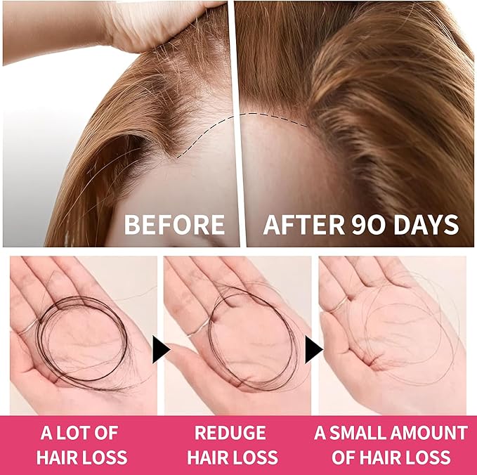 Women's Hair Growth Accelerator Supplement Gummies, Nourishes Thinning Hair & Boosts Hair Thickness, With Collagen, Biotin, Zinc, Vitamin C & Iron – Pineapple Flavor – 90 Gummies, 45 Day Supply