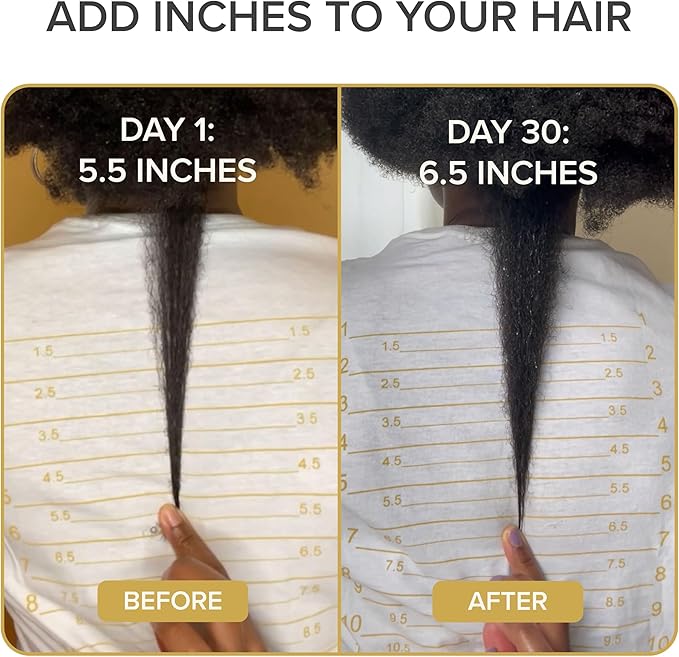 Shedavi Iconic Natural Hair Vitamins for Fast Hair Growth - Pure Hair Supplements Formulated with Vitamins to Promote Thicker, Stronger Hair - Vegan Hair Care for Hair Loss - Non-GMO (60 Capsules)