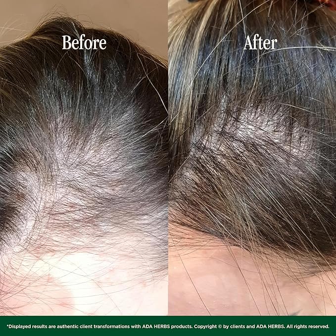 | 100% Natural Pre-Shower/Overnight Hair Oil Mask, Hair Treatment - Cold Pressed Oils, Vit. E, Squalane from Olive, (8.45 Fl. Oz.)